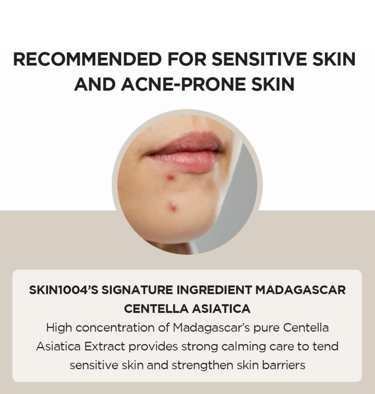 SKIN1004 MADAGASCAR CENTELLA ASIATICA AMPOULE FACE SERUM