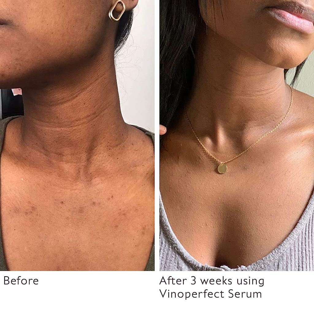 CAUDALIE VINOPERFECT RADIANCE DARK SPOT SERUM - 62x EFFECTIVE THAN VITAMIN C