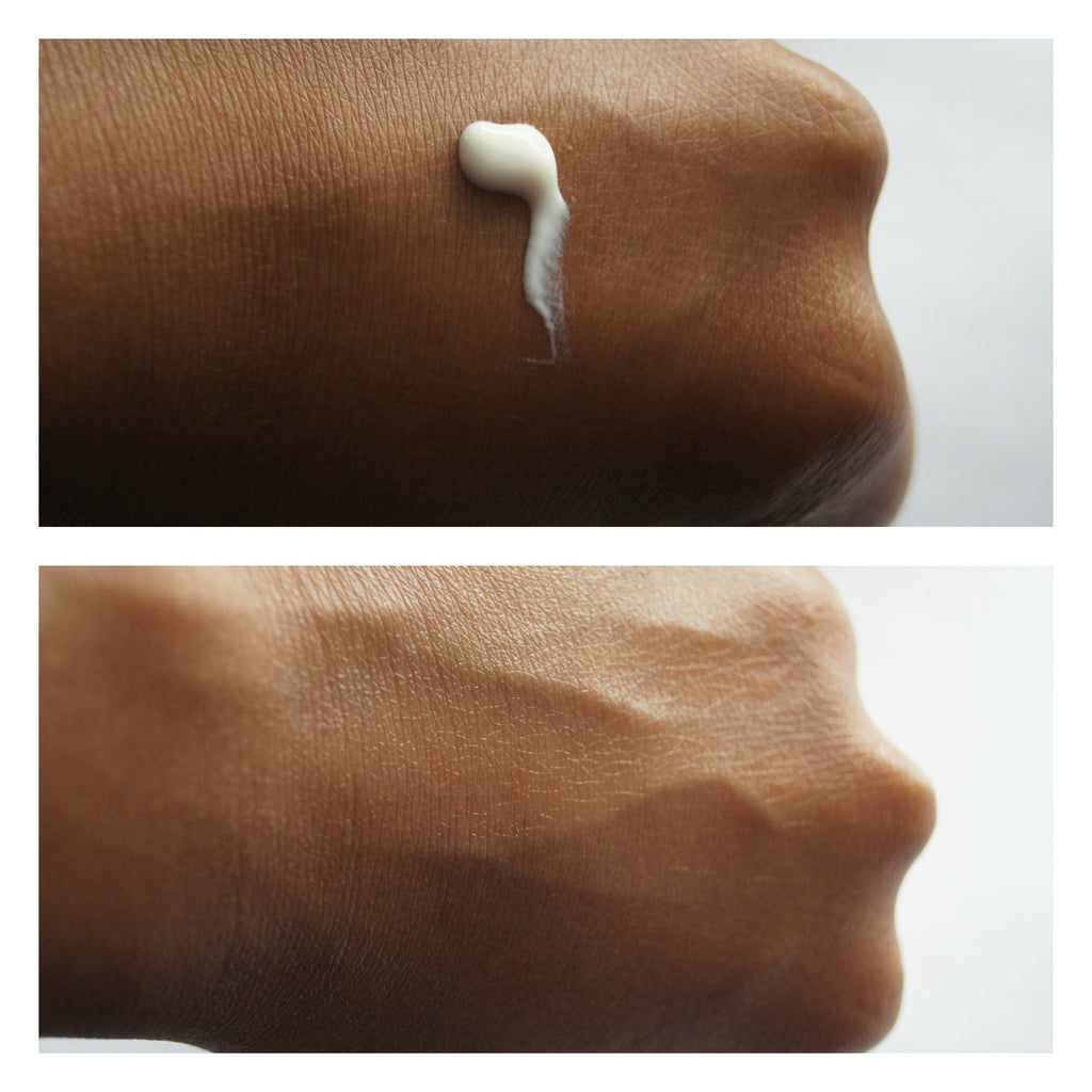 Skin Aging