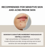 SKIN1004 MADAGASCAR CENTELLA ASIATICA AMPOULE FACE SERUM