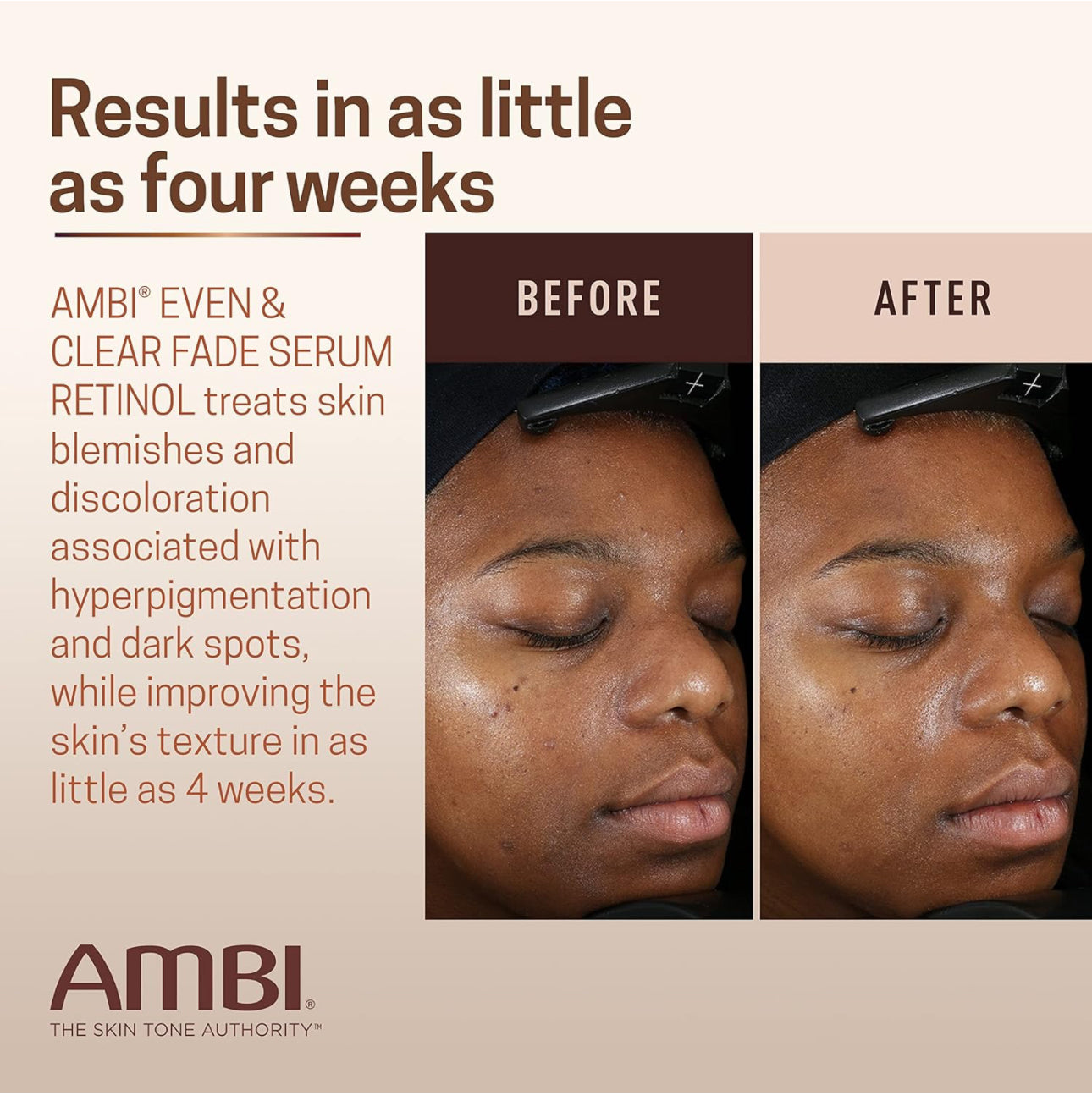 AMBI EVEN & CLEAR FADE SERUM