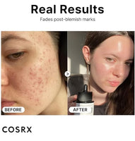 COSRX NIACINAMIDE 15% FACE SERUM