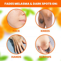 NEOPROSONE WITH VITAMIN C BRIGHTENING SERUM