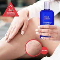 TEND SKIN - SKIN CARE SOLUTION FOR RAZOR BUMPS, INGROWN HAIR AND RAZOR BURNS
