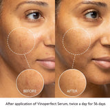 CAUDALIE VINOPERFECT RADIANCE DARK SPOT SERUM - 62x EFFECTIVE THAN VITAMIN C