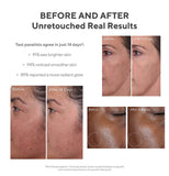 MURAD ENVIRONMENTAL SHIELD RAPID DARK SPOT CORRECTING SERUM
