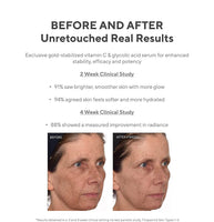 MURAD ENVIRONMENTAL SHIELD VITA-C GLYCOLIC BRIGHTENING SERUM
