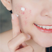 NEUTROGENA RAPID CLEAR STUBBORN ACNE SPOT GEL