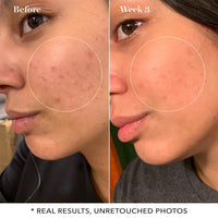 SATURDAY SKIN PORE CLARIFYING  TONER