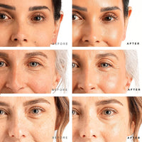 TREE OF LIFE FACE SERUMS